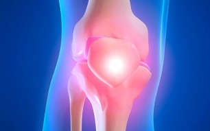 causes of arthrosis of the knee joint