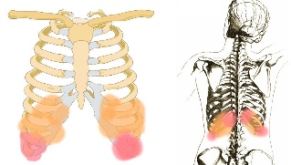 back pain under ribs symptoms