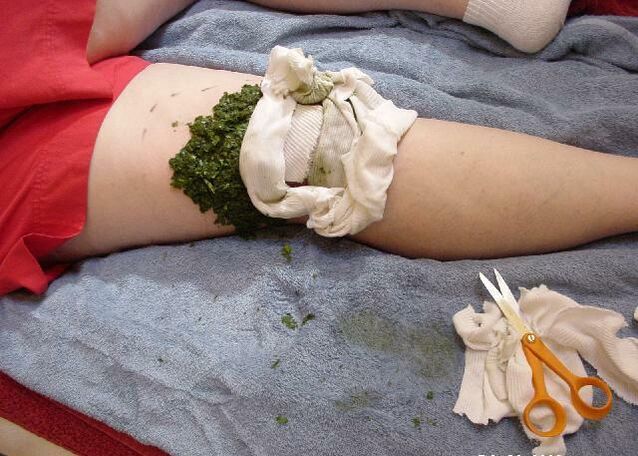 A warm compress of crushed cabbage leaves on a sore knee joint with arthrosis