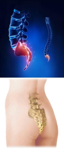 back pain tailbone